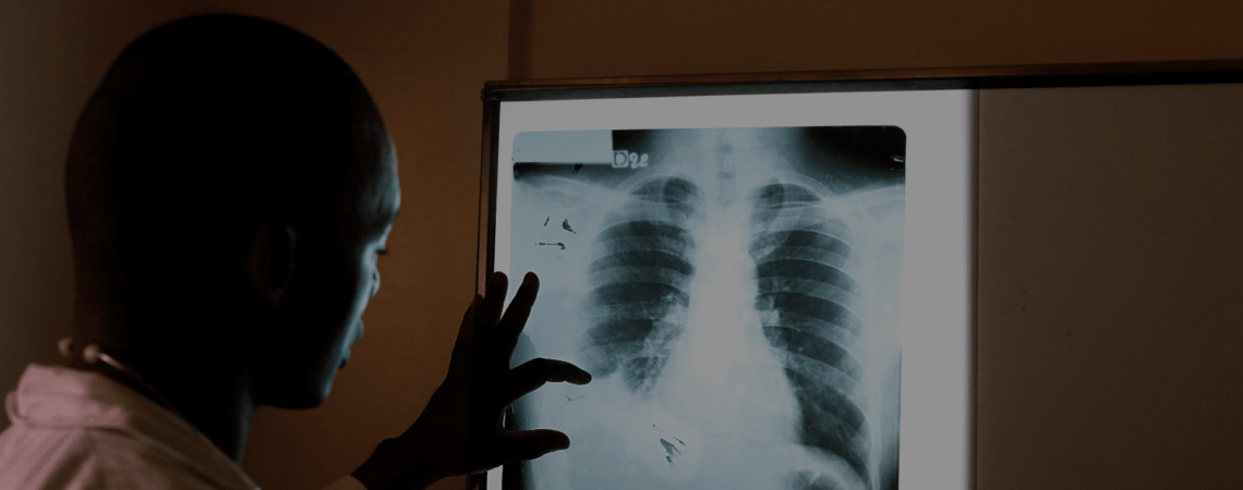 Médecin regardant la radio du poumon d'un patient à la recherche de traces de la tuberculose